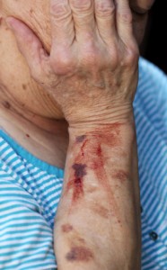 information on elder abuse